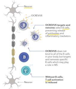 How Does OCREVUS Work? | Get On With Life